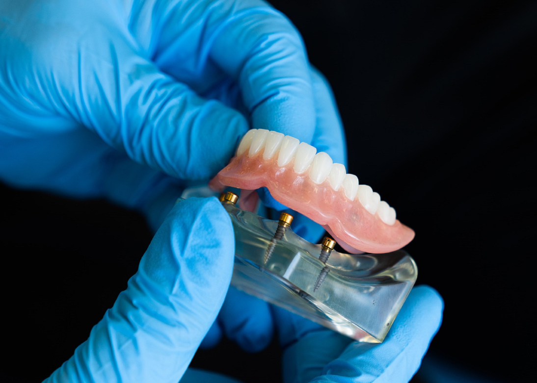 Complete Dentures