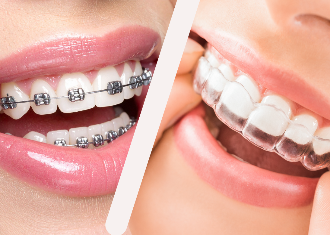 Orthodontics